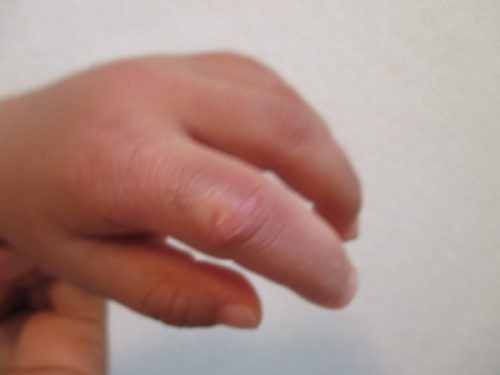 指しゃぶりをやめさせる方法は 小児歯科専門医に聞いてきました ママと子供のｈａｐｐｙ ｌｉｆｅ